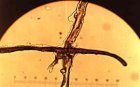 Gum encrusted cotton fiber found only in the carbon 14 sample area and not elsewhere on the Shroud of Turin.