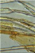 Gum material is swelling and detaching from fibers. Chemical tests show that dye is yellow alizarin from madder root
